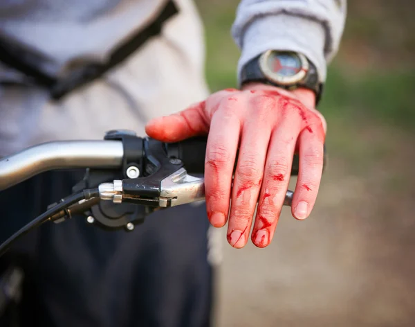 Cyclist with blood all over his hands